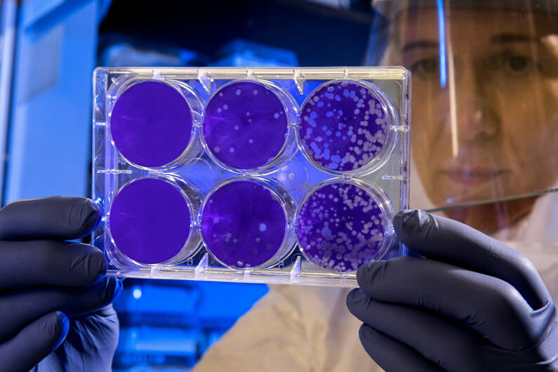 Imagem de um cientista em uniforme de pesquisa segurando uma placa com vírus para ilustrar post cujo título diz que uma entidade biológica totalmente nova foi descoberta em nosso corpo.