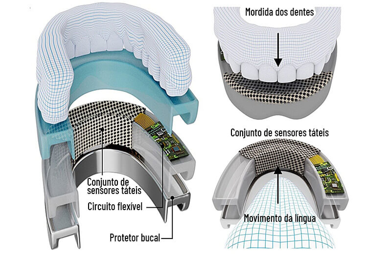 Imagem esquemática da arcada dentária humana com um protetor bucal e sensores táteis para ilustrar o post cujo título diz que um protetor bucal pode controlar dispositivos com a língua e os dentes.